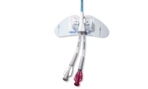 Statlock PICC Plus bevestigingsstysteem